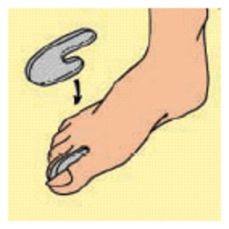 S017LF GEL TOE SPRE DIS DITA L